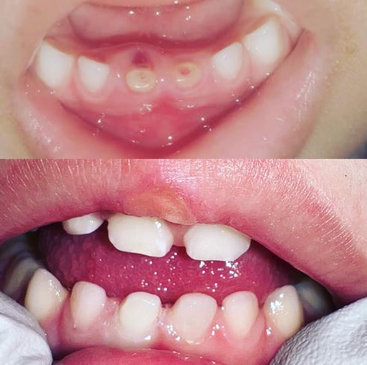 Slider image (3) Infantident